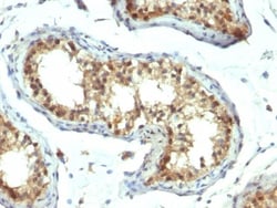 Pax7 Antibody (PAX7/1187), Novus Biologicals 0.2mg; Unlabeled:Antibodies,